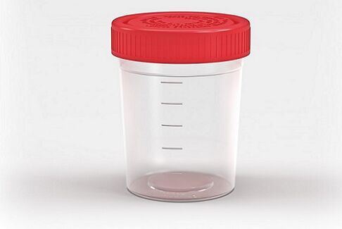 container for parasite testing