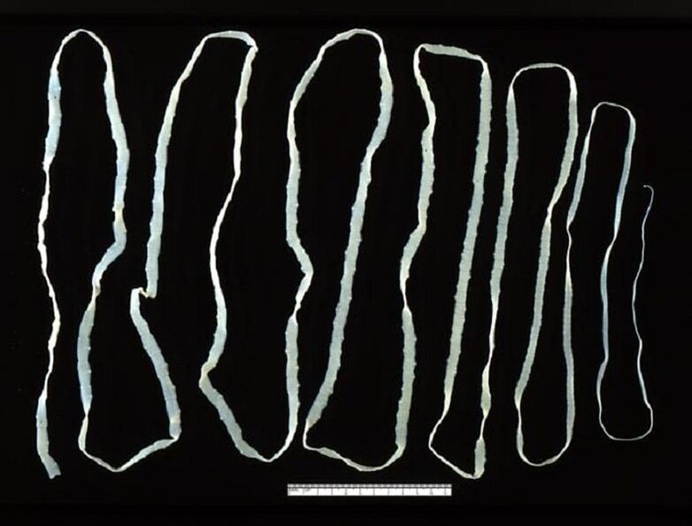 Tapeworms are extracted from the human intestine