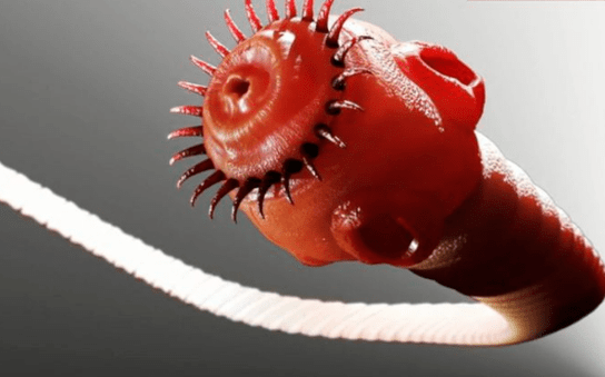 worm parasites of the human body