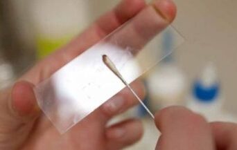 What test should be taken for parasites