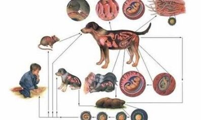 The cause and way of infection with worms